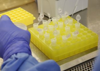 Governo do Ceará lança mapa com rede de assistência para o Covid-19; saiba onde fazer o exame