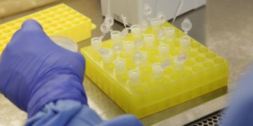 Governo do Ceará lança mapa com rede de assistência para o Covid-19; saiba onde fazer o exame