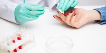 Universidade Federal Do Ceará (UFC) Desenvolve Teste Mais Rápido e Barato Para Covid-19