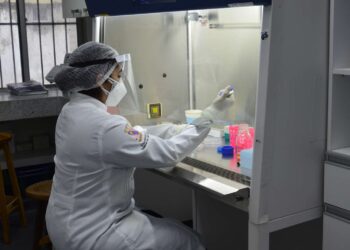 Uece desenvolve teste rápido para diagnóstico da Covid-19