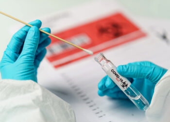 Onde fazer gratuitamente seu teste para Covid-19 em Fortaleza?