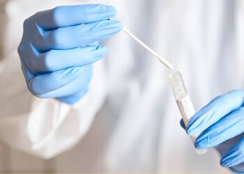 Saiba onde você pode fazer o teste de Covid-19 em Fortaleza gratuitamente